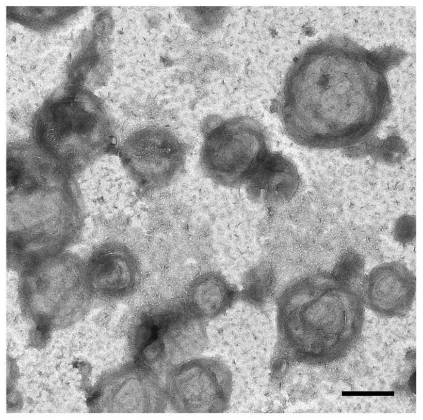 A method for preparing extracellular vesicles and its application