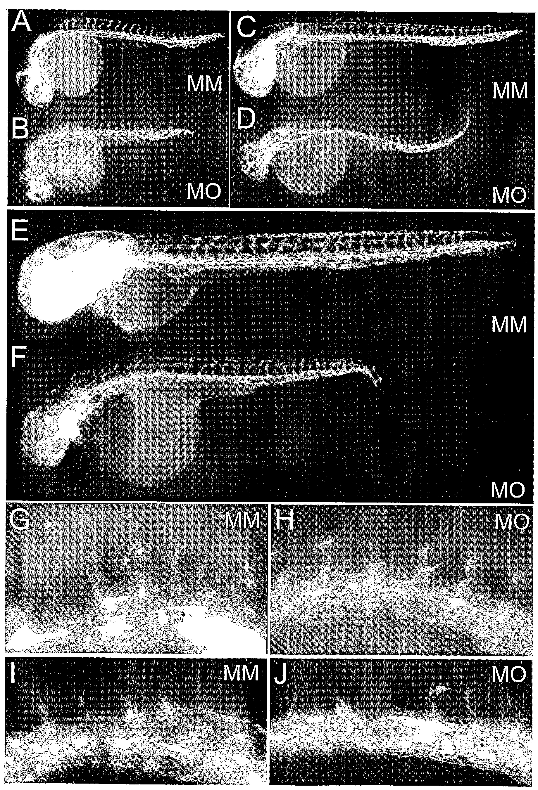 Methods and compositions for the treatment and diagnosis of endothelial cell disorders and angiogenic disorders