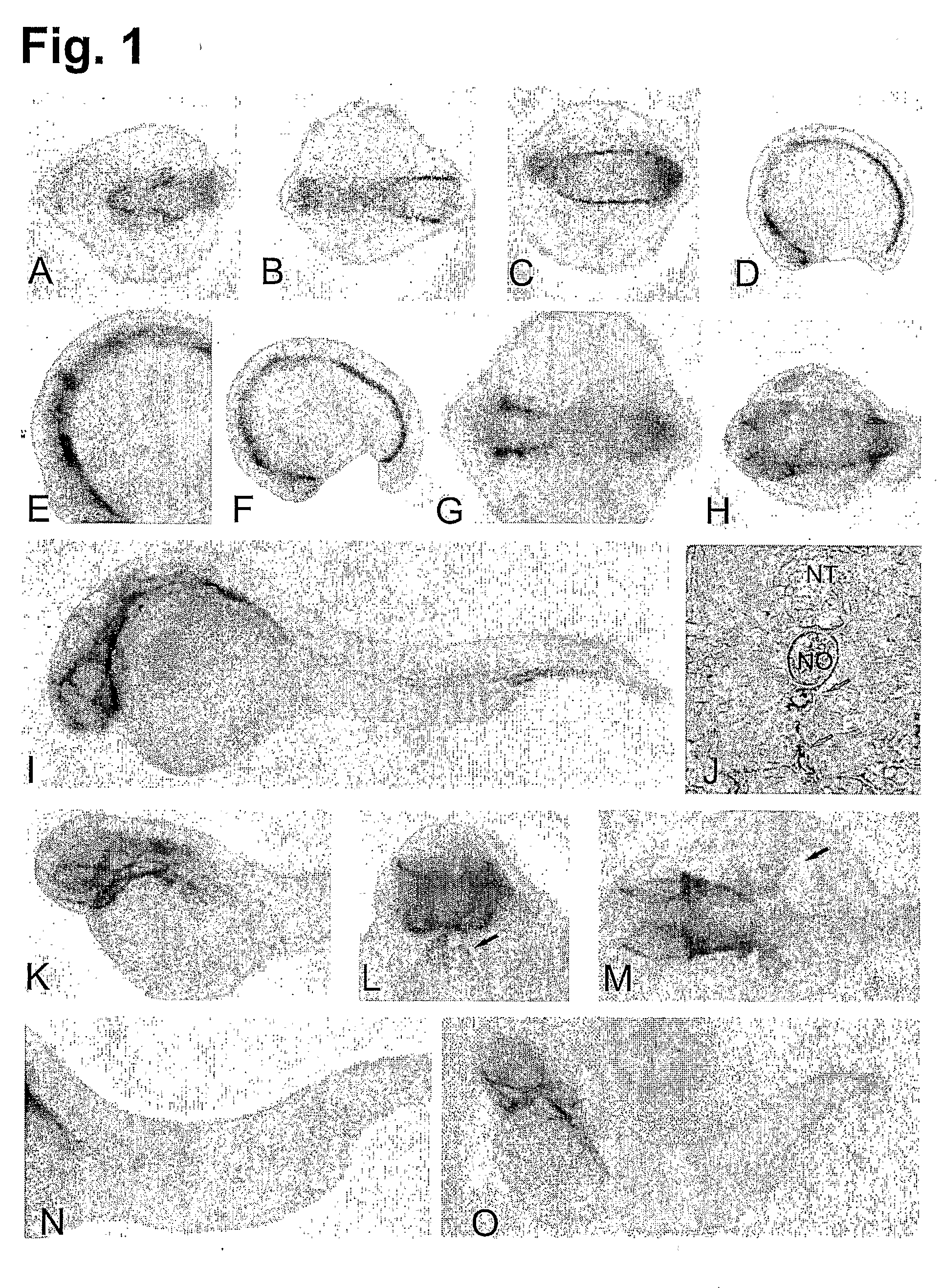 Methods and compositions for the treatment and diagnosis of endothelial cell disorders and angiogenic disorders