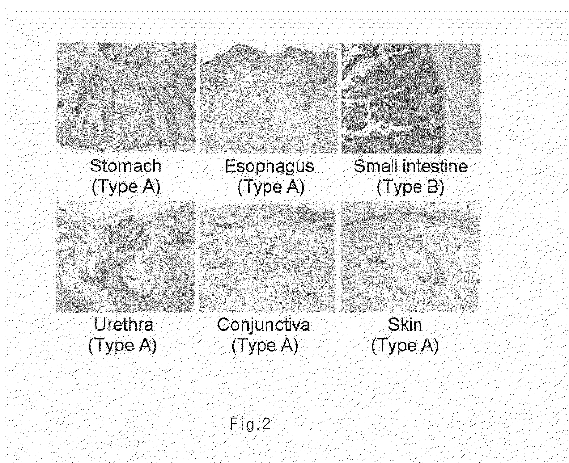 Composition for improving inflammatory disease using abh antigens