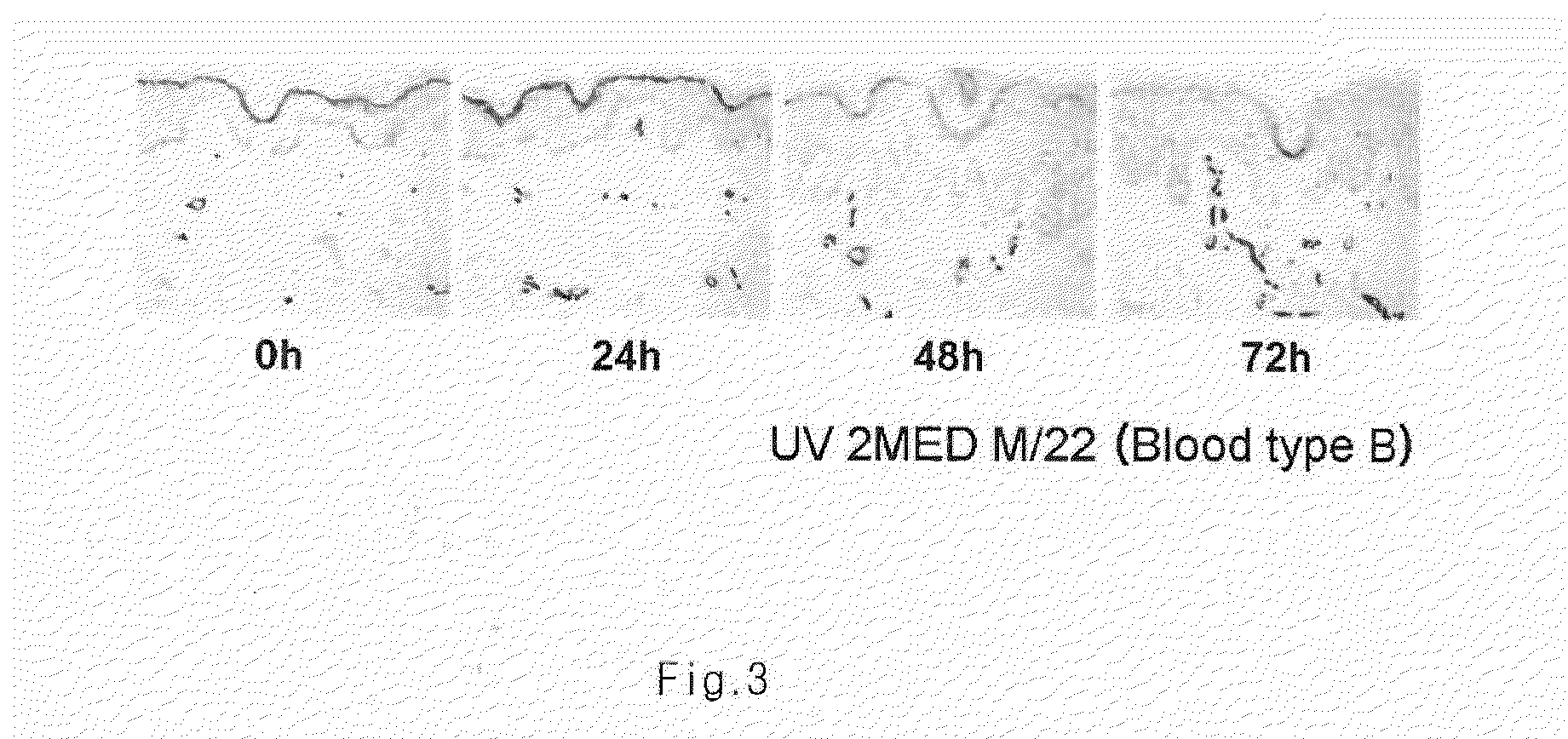 Composition for improving inflammatory disease using abh antigens