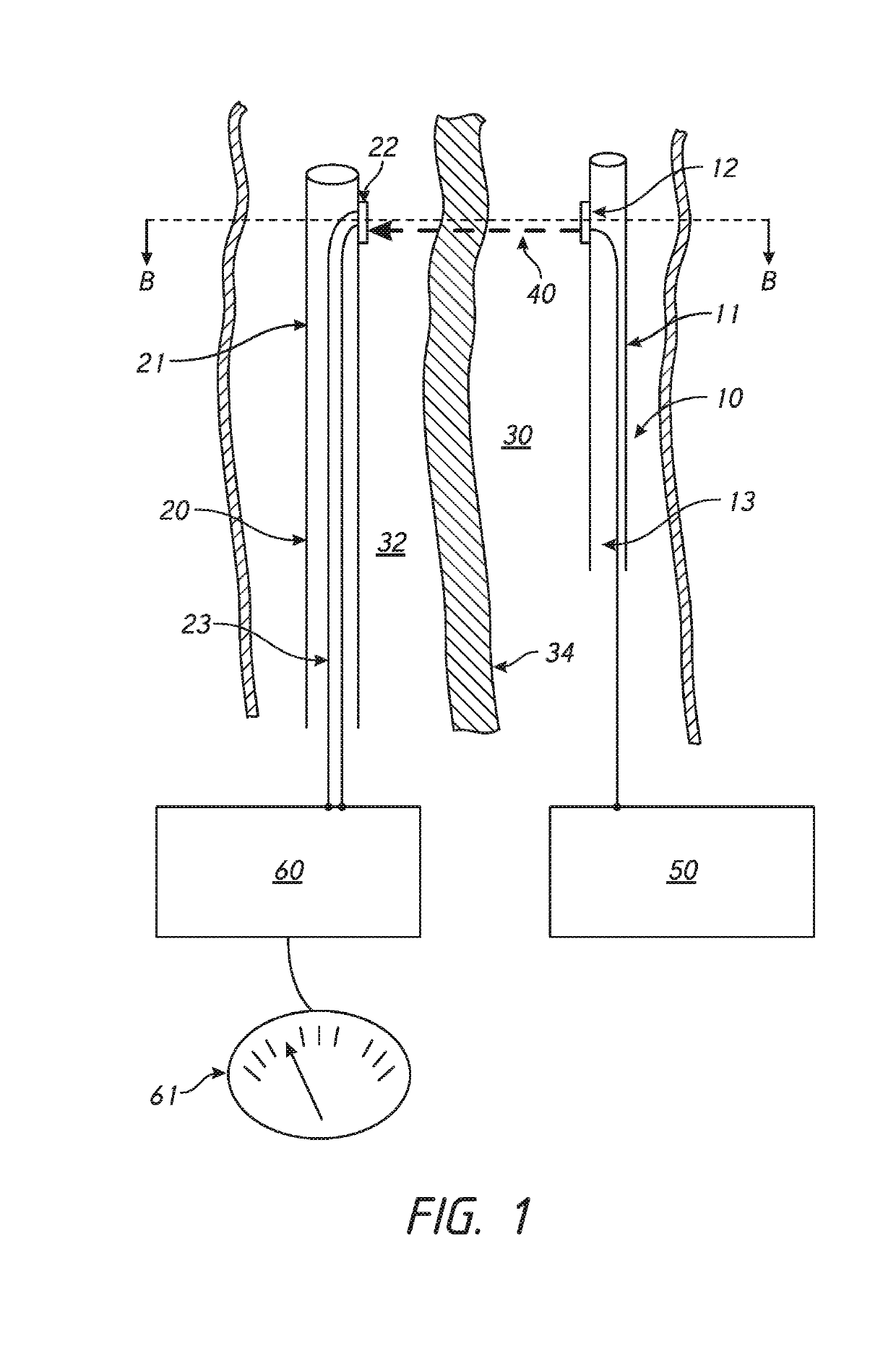 Devices and methods for treating lower extremity vasculature