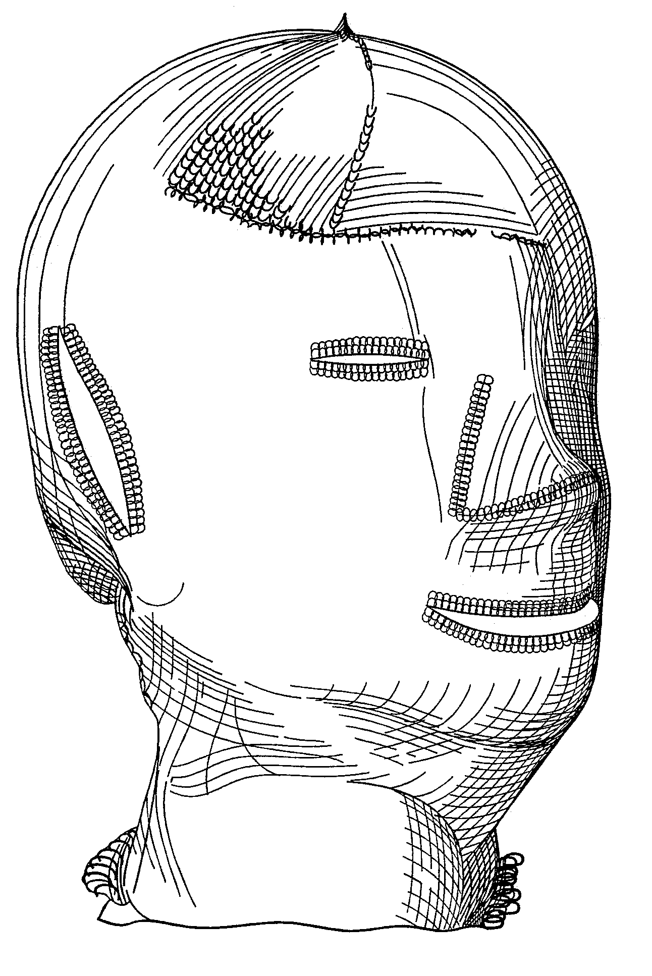 Carboxymethylated cellulosic wound dressing garment