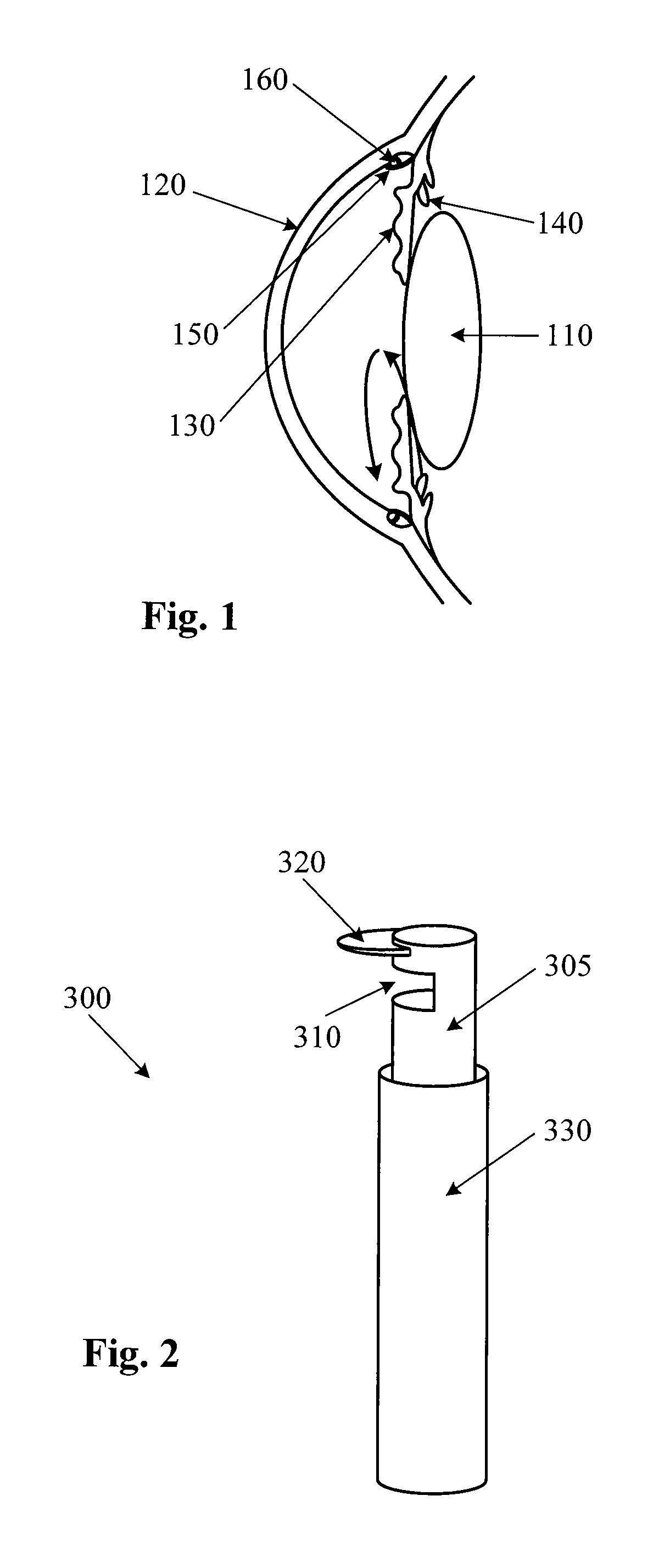 Pulsed Electric Field Probe for Glaucoma Surgery