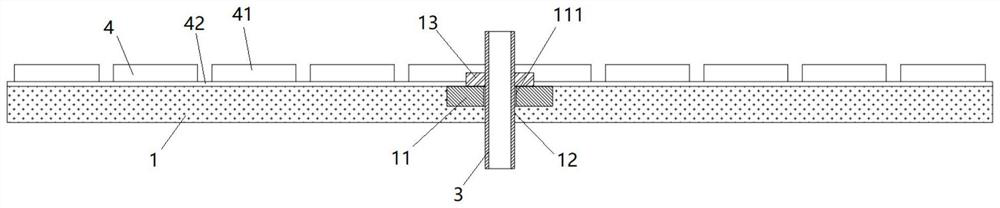 Postoperative compression drainage device for parotid gland and using method