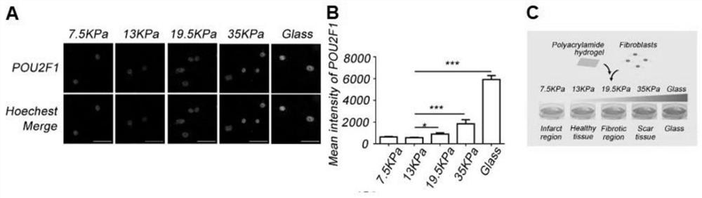 Application of pou2f1 gene expression inhibitor in the preparation of medicaments for the treatment of tissue fibrosis