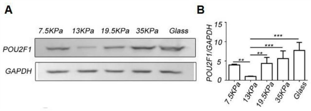 Application of pou2f1 gene expression inhibitor in the preparation of medicaments for the treatment of tissue fibrosis