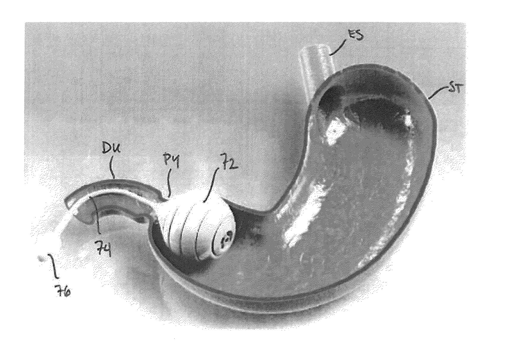 Locking gastric obstruction device and method of use