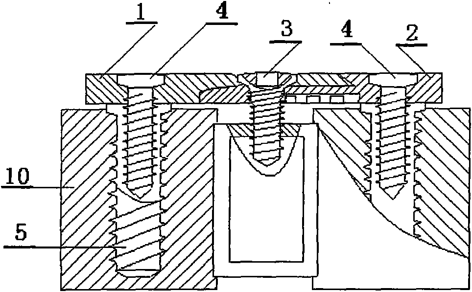 Combined compression locking type anterior cervical resetting fixture