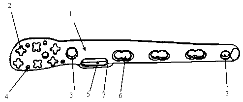 Distal fibula C-type bone fracture band lateral wing locking setting structure