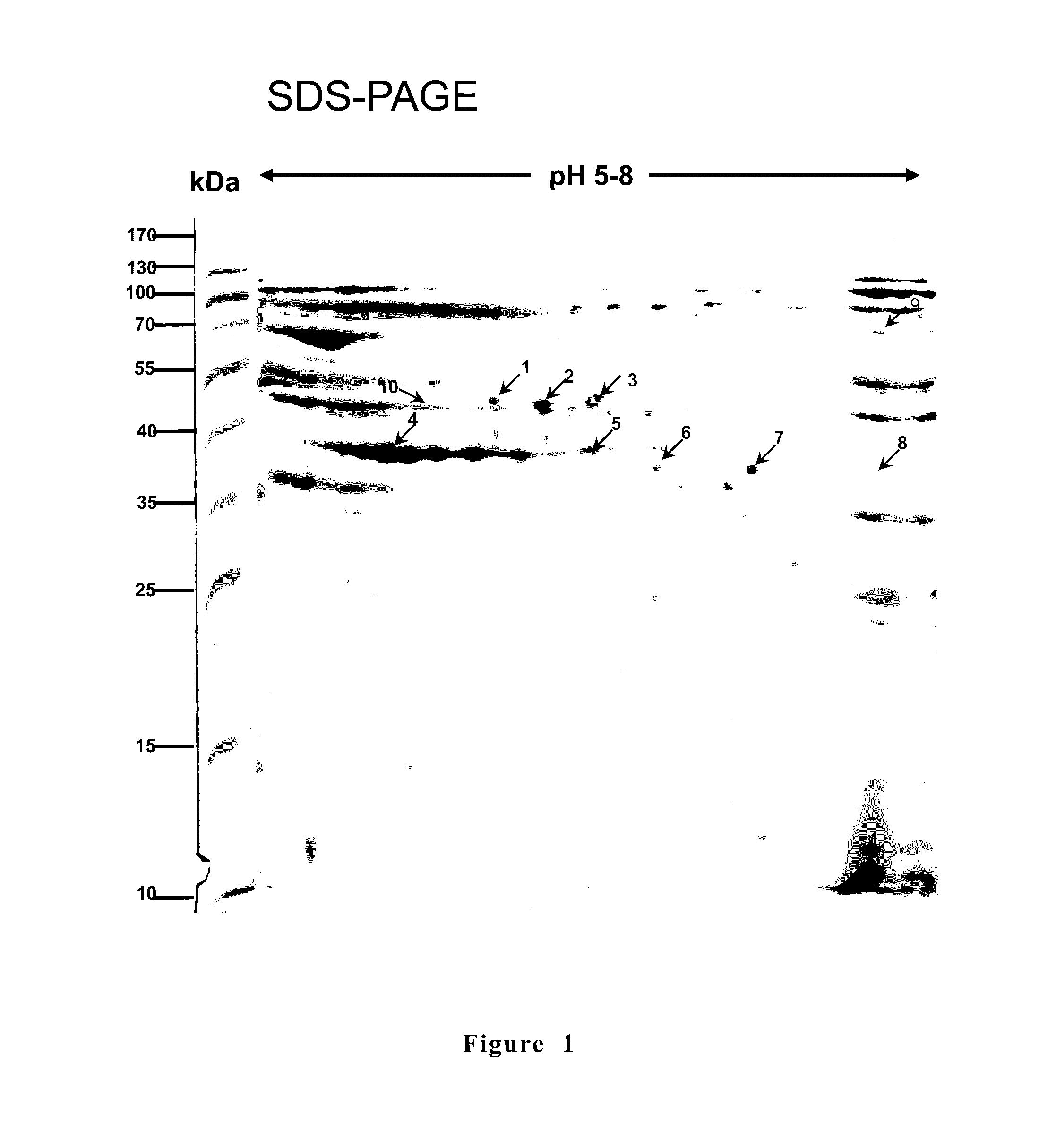 Anti-<i>Mycoplasma </i>spp. subunit vaccine