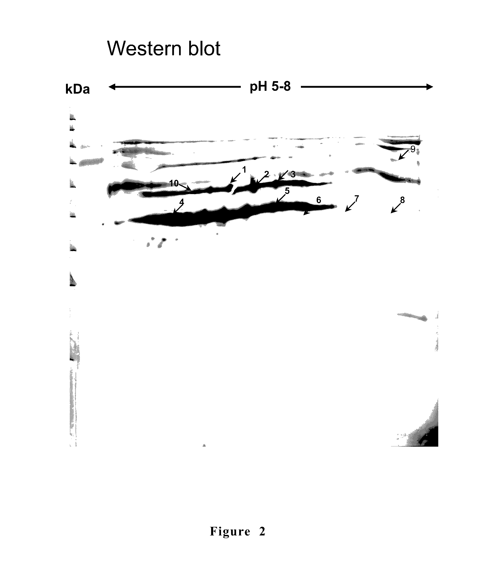 Anti-<i>Mycoplasma </i>spp. subunit vaccine