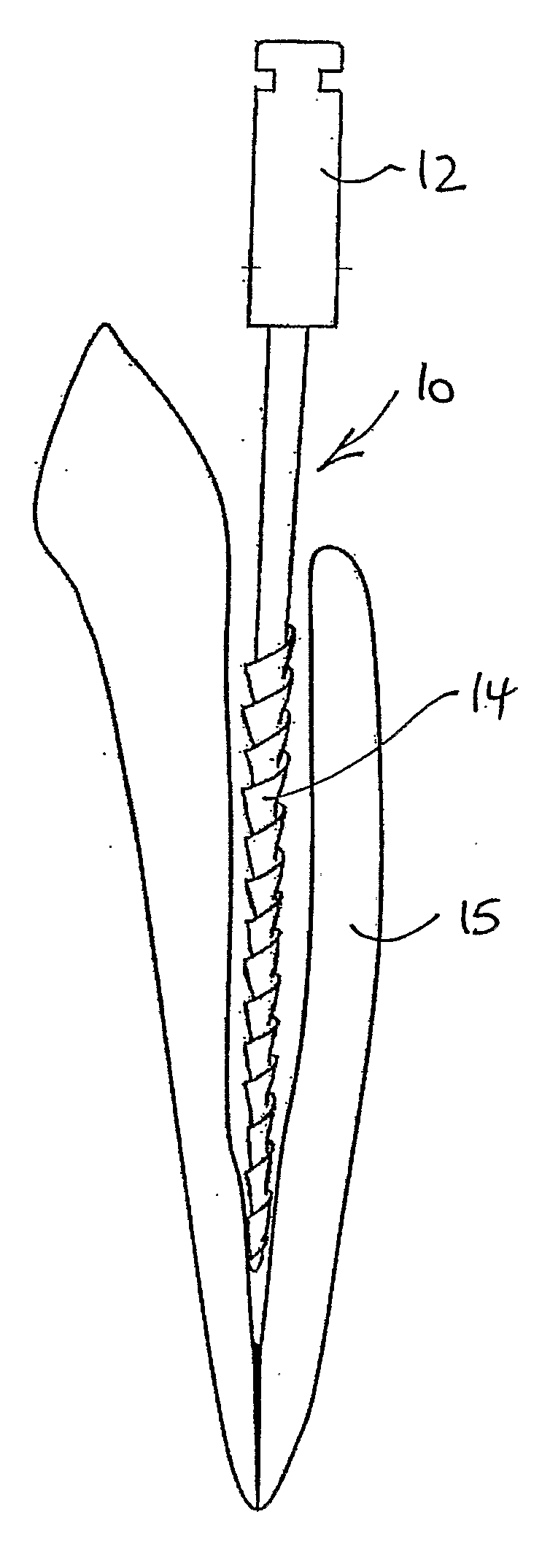 Dental apparatus for shaping and cleaning a root canal