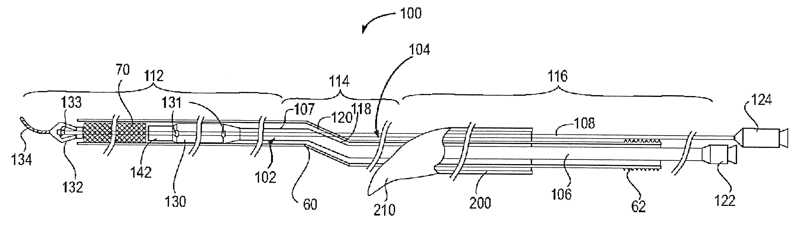 Apparatus and methods for protected angioplasty and stenting at a carotid bifurcation