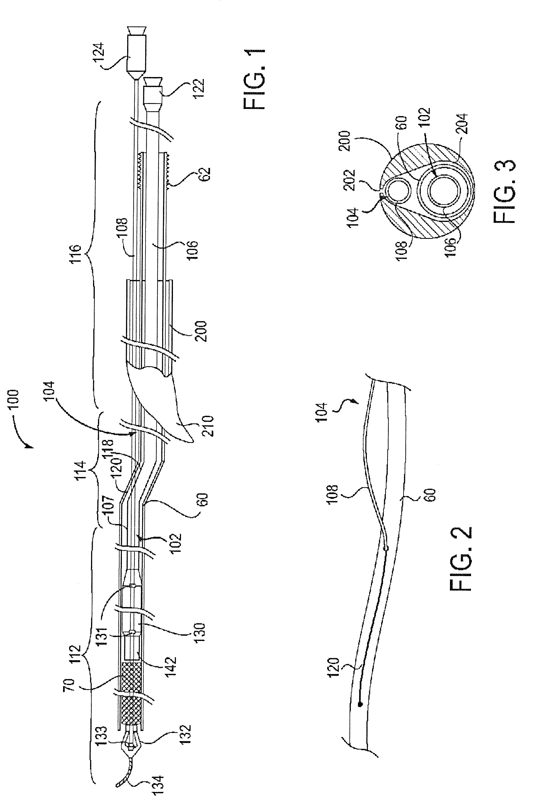 Apparatus and methods for protected angioplasty and stenting at a carotid bifurcation