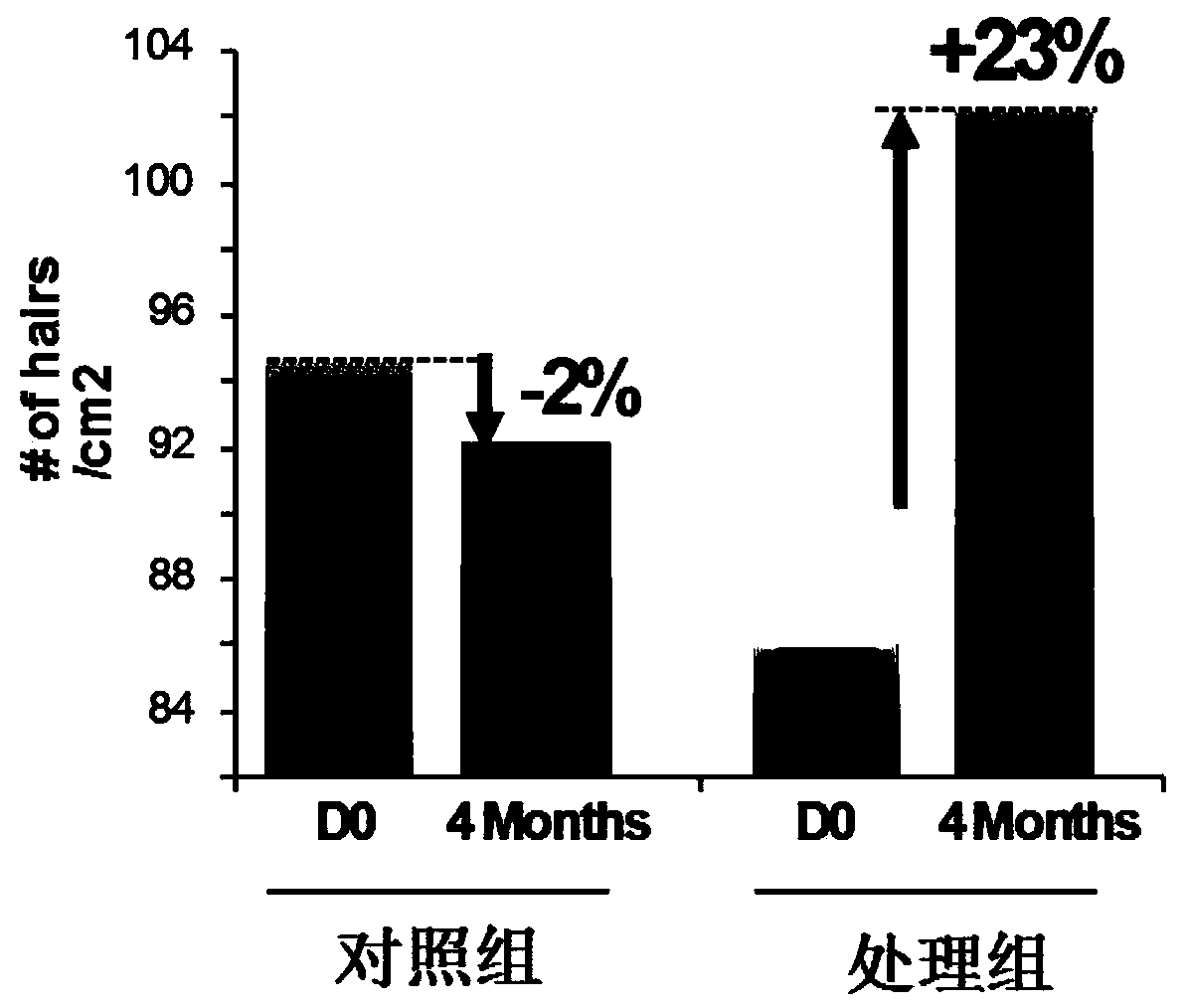 Anti-hairloss composition and preparation method