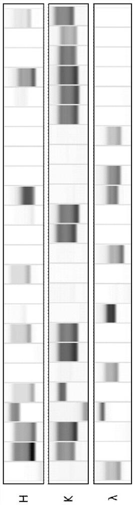 Monoclonal Antibody 5a8 Binding Specifically to Ebola Virus Glycoproteoglycan Cap