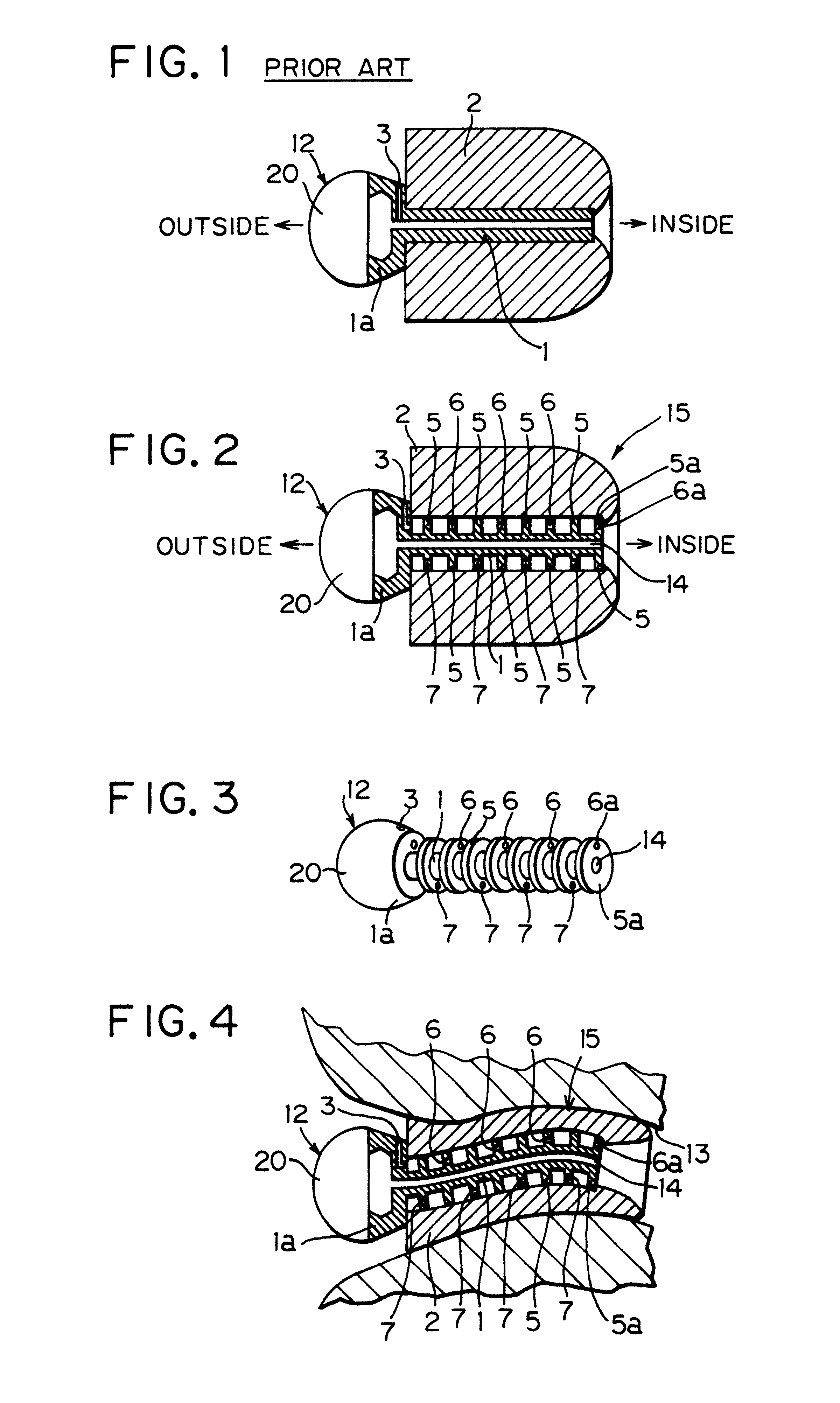 Ear plug to be inserted into the external auditory canal