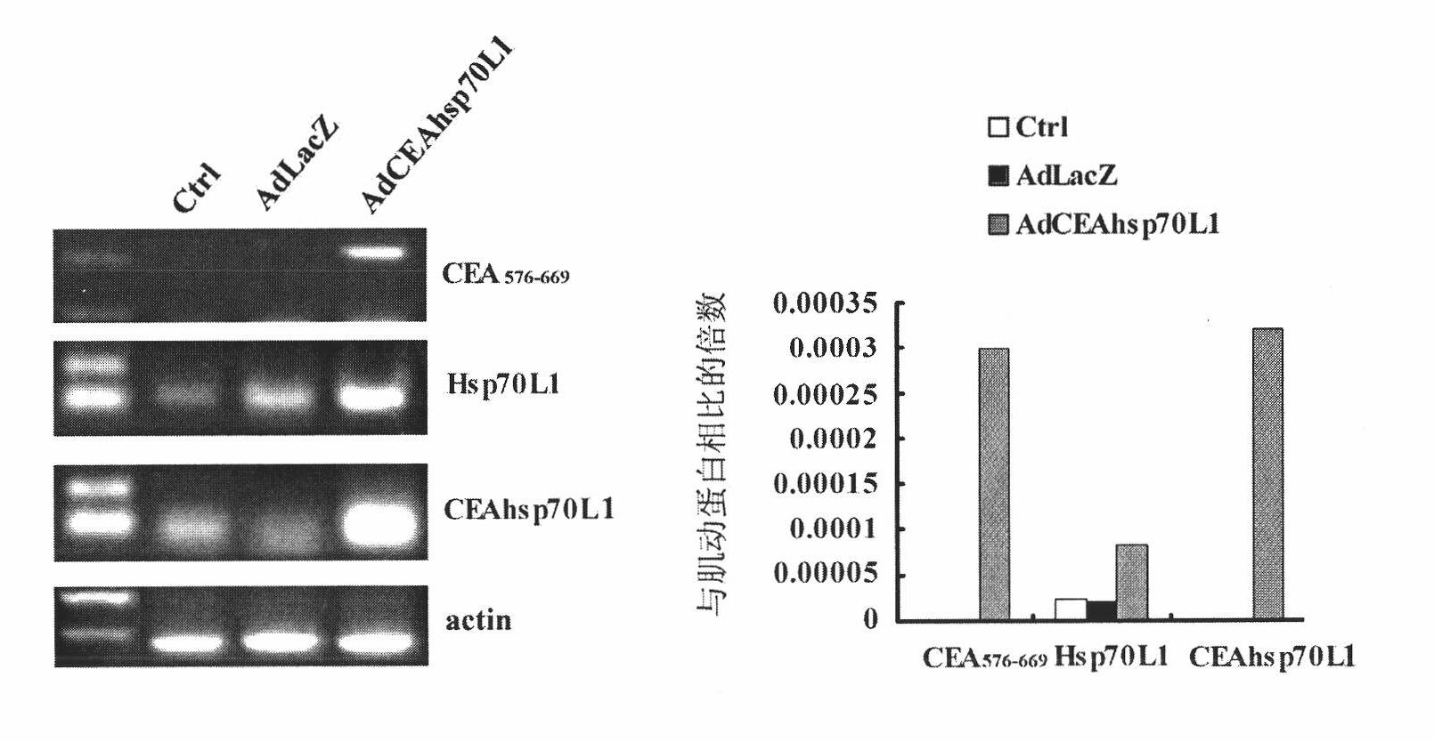 Recombinant adenovirus with fusion protein gene and preparation method and application thereof