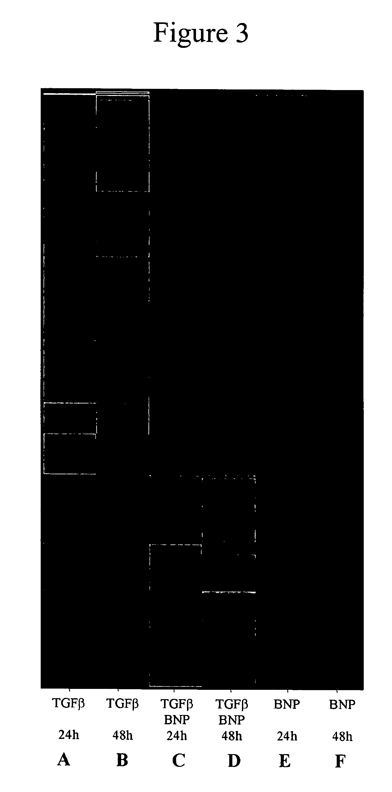 Method for treating cardiac remodeling following myocardial injury