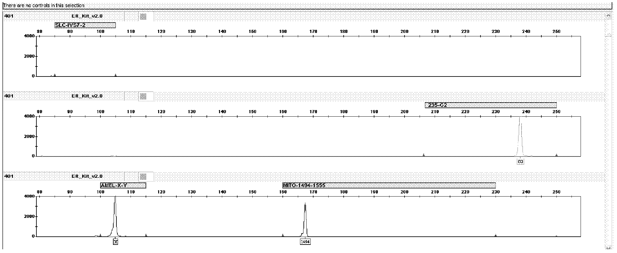 Kit for jointly detecting four deafness predisposing genes and application thereof