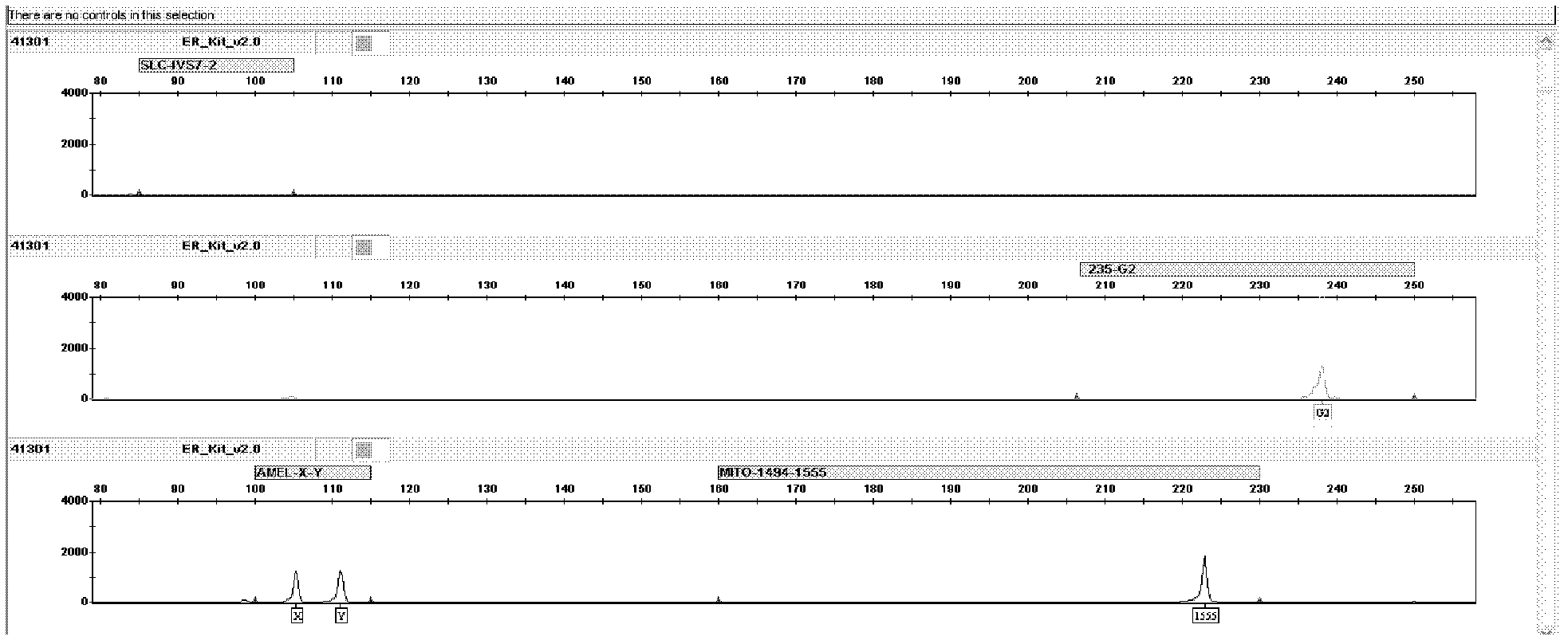 Kit for jointly detecting four deafness predisposing genes and application thereof