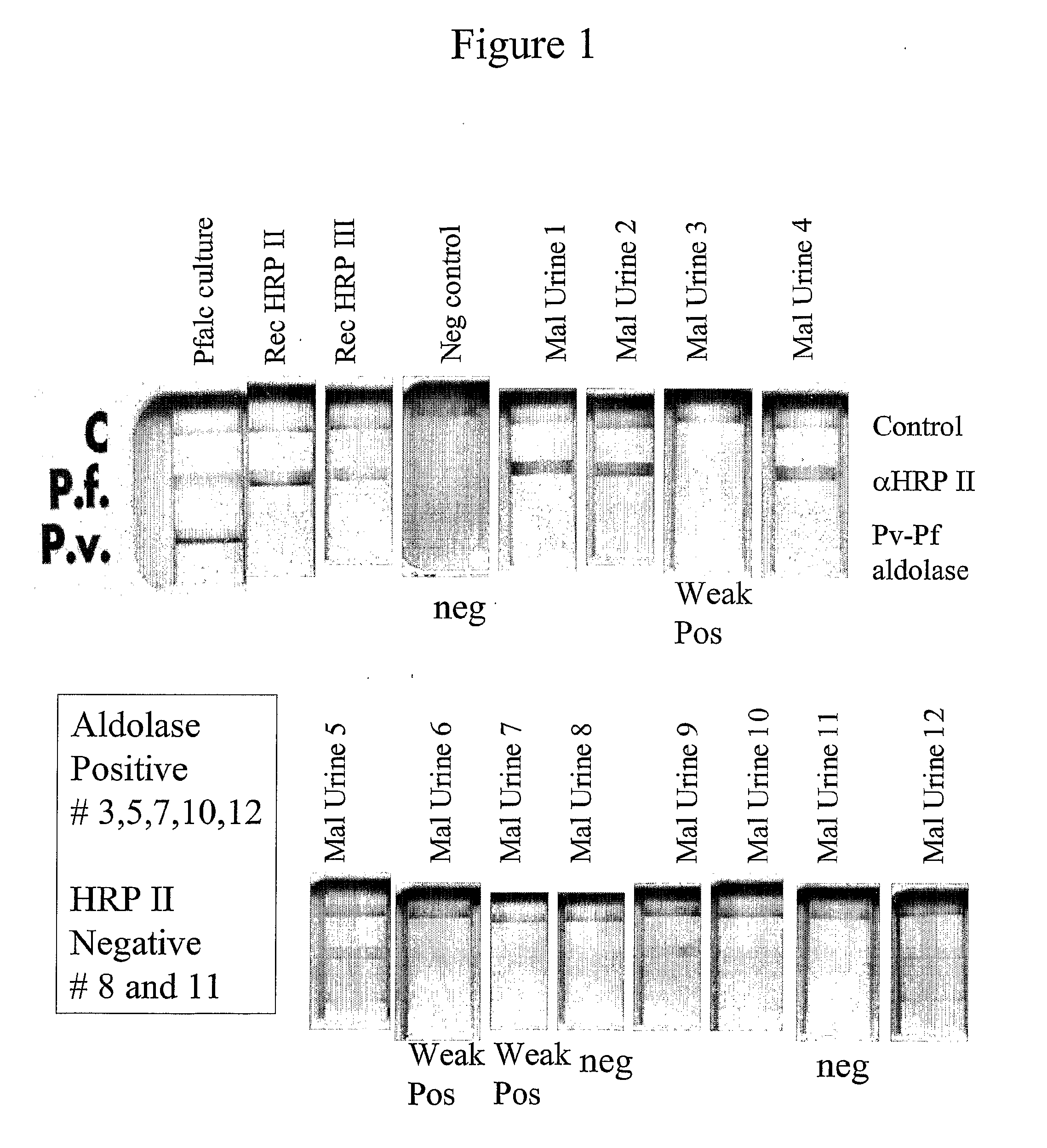 Plasmodium Diagnostic Assay Device