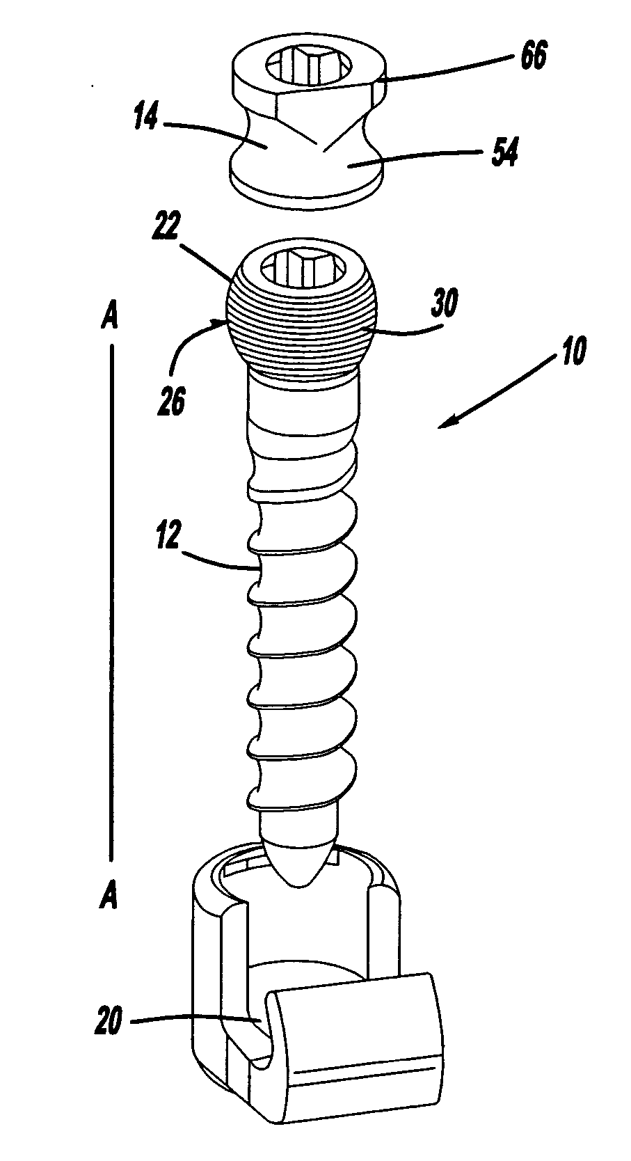 Screw and rod fixation assembly and device