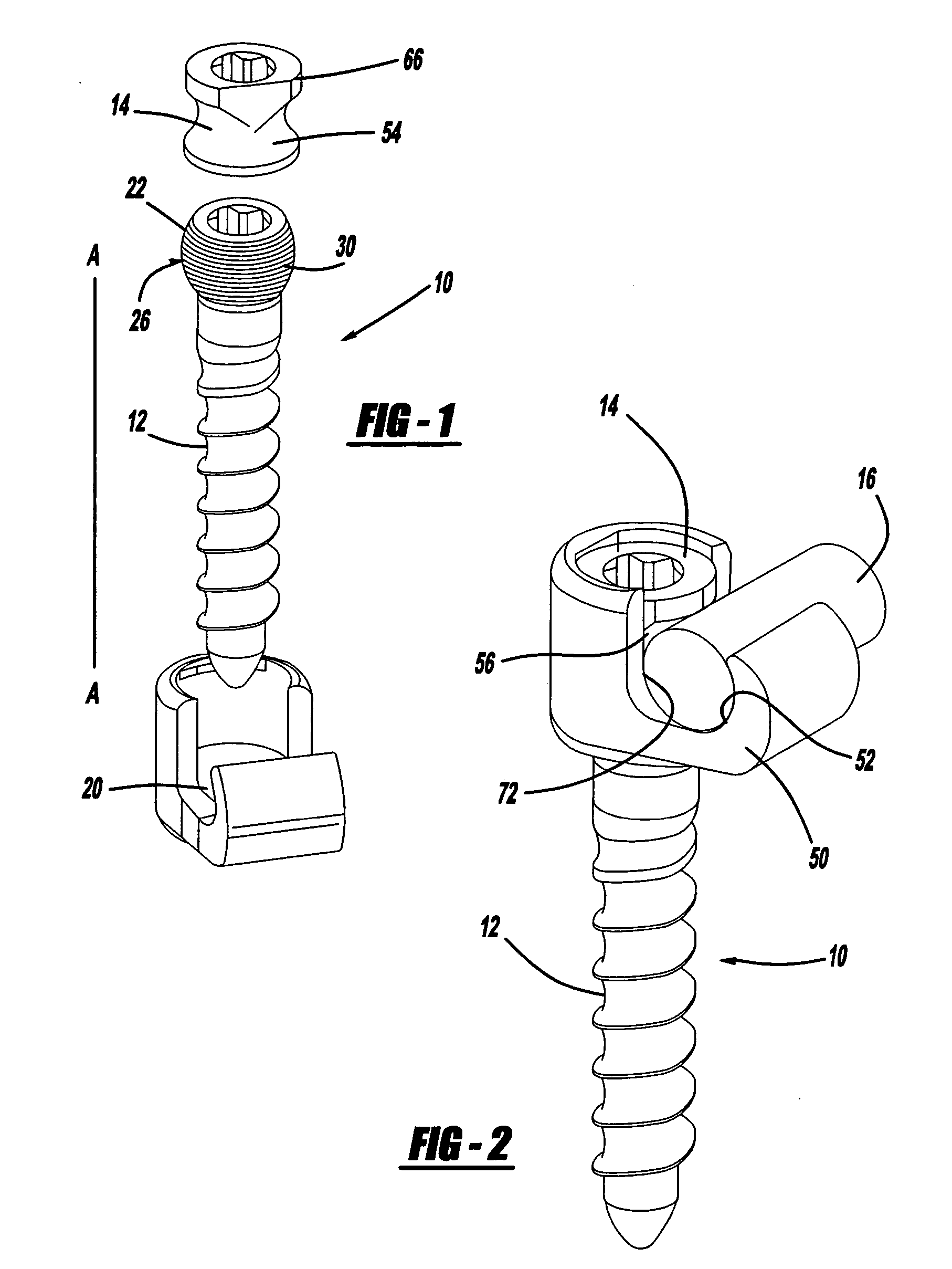 Screw and rod fixation assembly and device