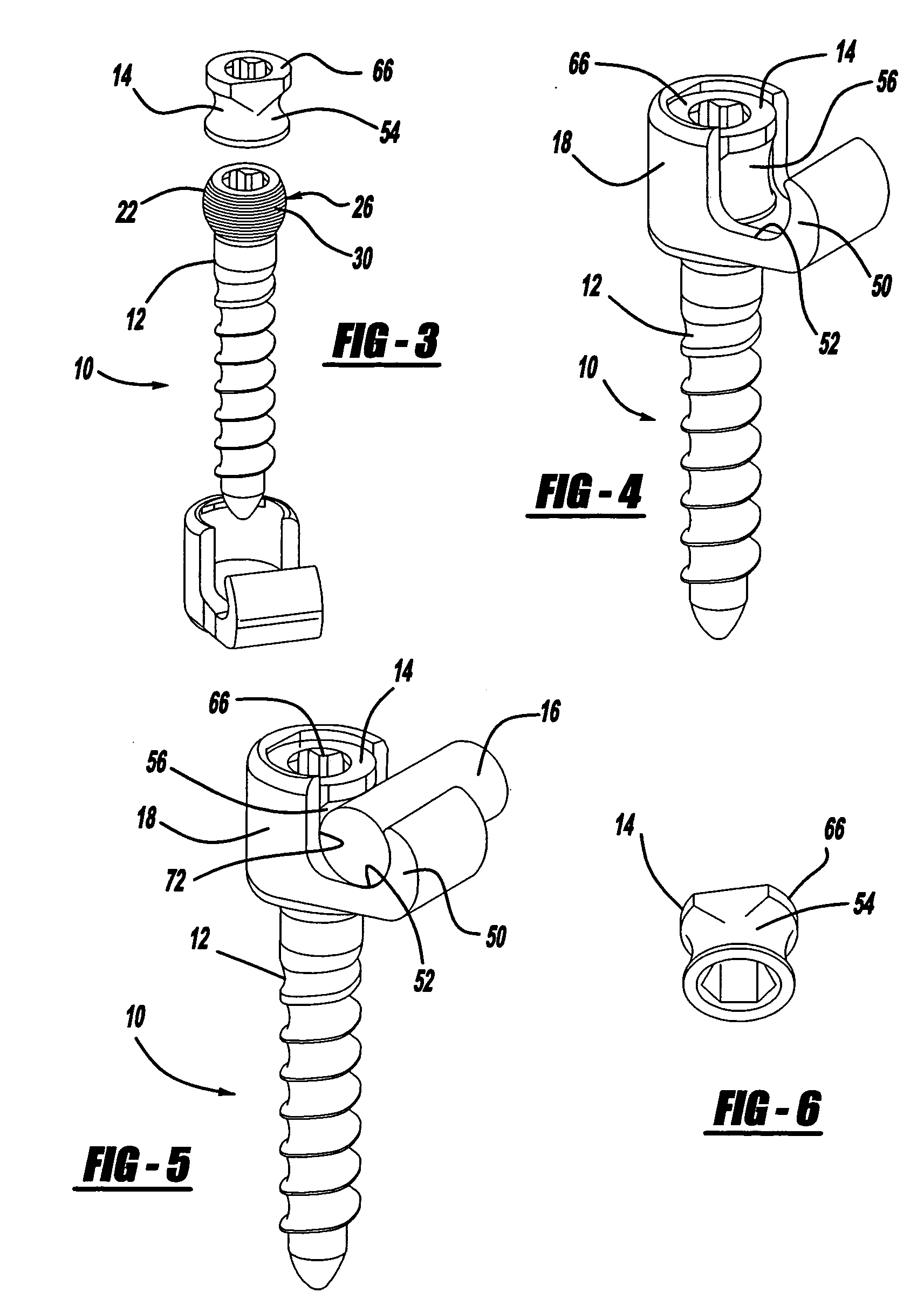 Screw and rod fixation assembly and device