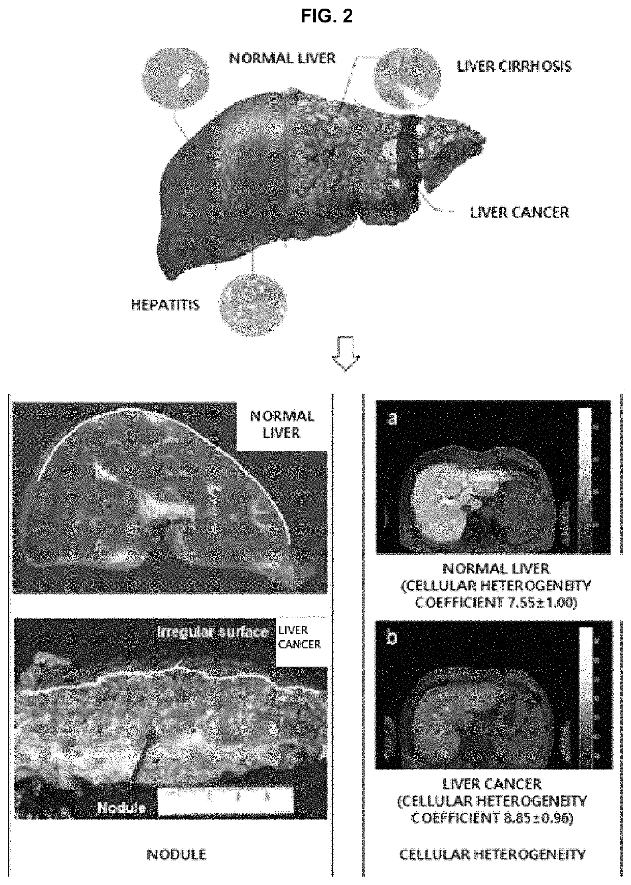 Method and apparatus for calculating abdominal disease diagnosis information based on medical image