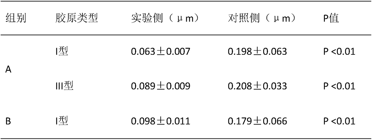 Biomimetic chitosan filling agent for preventing capsule contracture and preparation method thereof