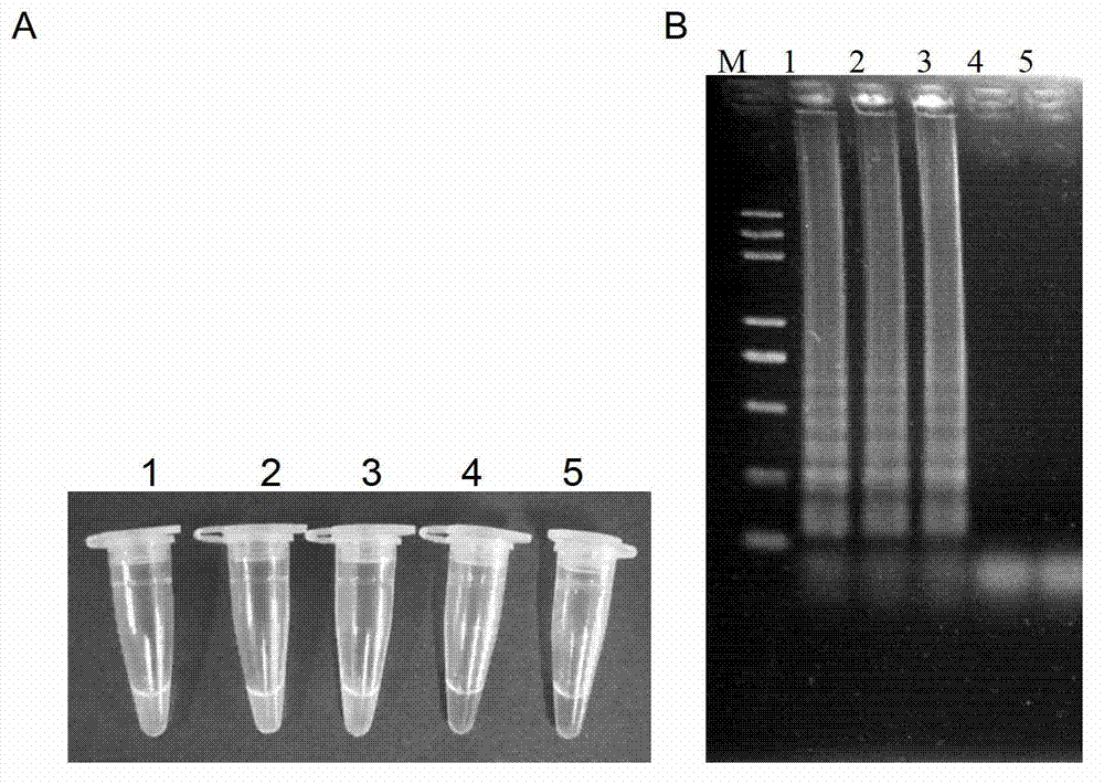 Reagent kit for detecting tomato yellow leaf curl virus carried by single-head whiteflies