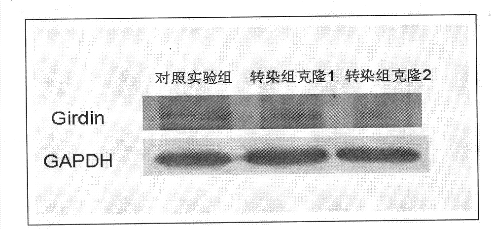 Cytoskeletal binding protein siRNA (small interfering ribonucleic acid) interfering sequence, fusion expression vector thereof and medical application of same