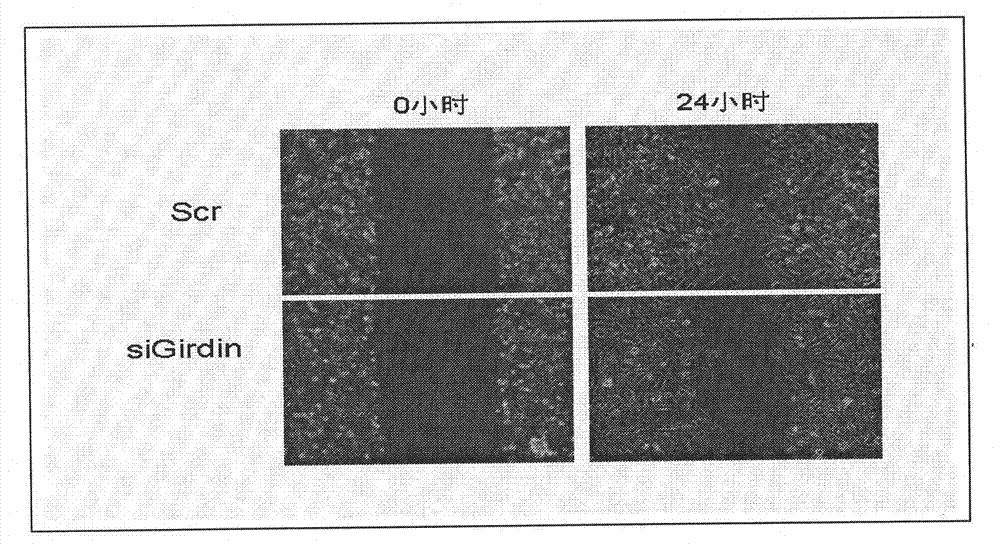 Cytoskeletal binding protein siRNA (small interfering ribonucleic acid) interfering sequence, fusion expression vector thereof and medical application of same