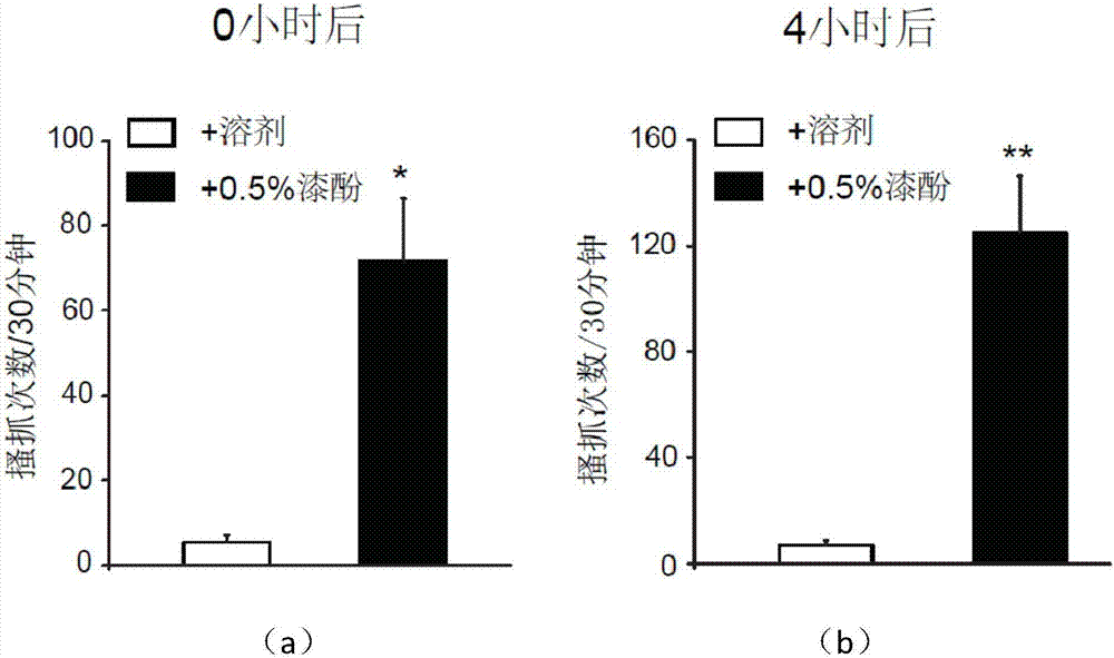 Application of anti-TSLP antibody in preparation of drugs for treating chronic pruritus