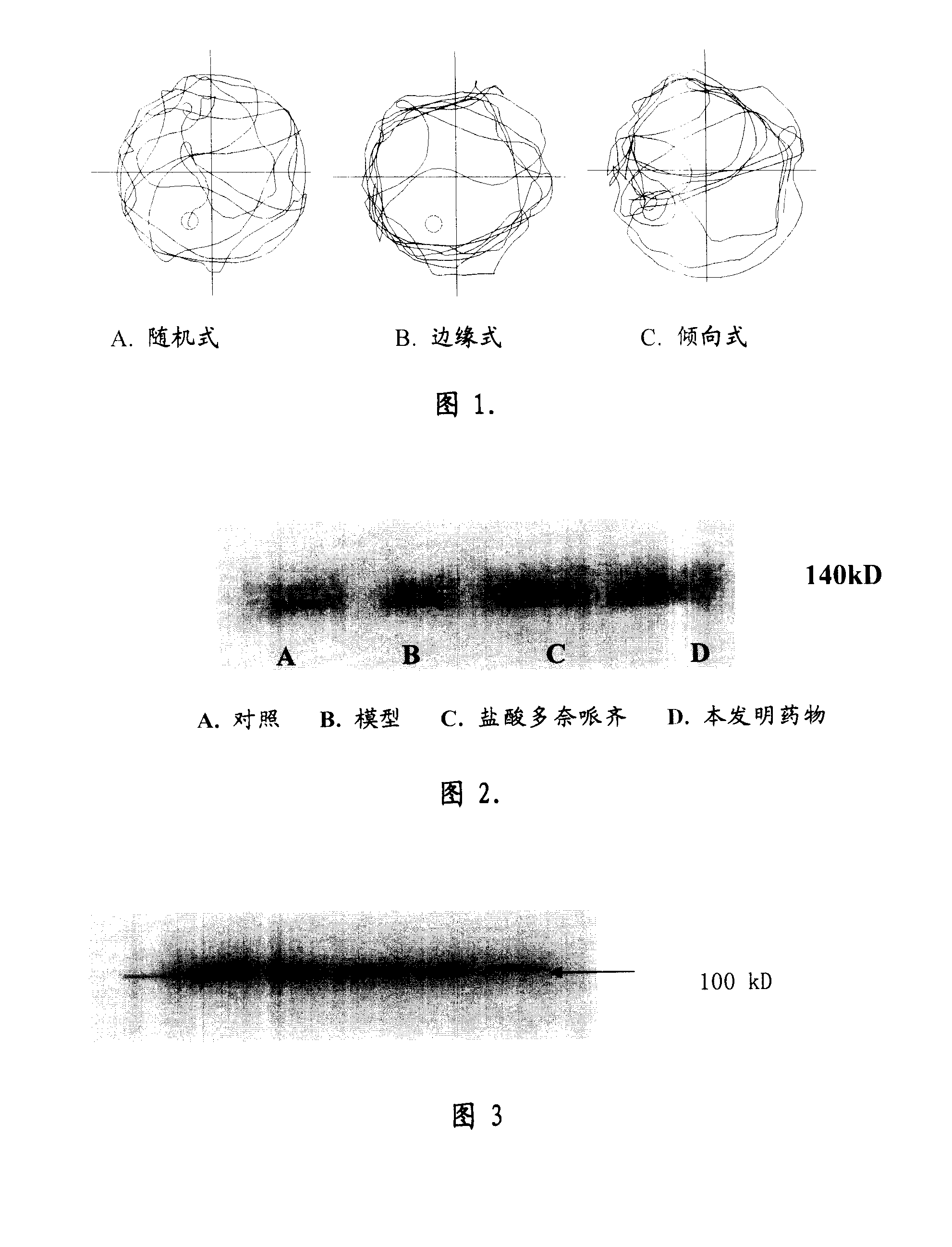 Medicine for treating senile dementia and preparing method thereof