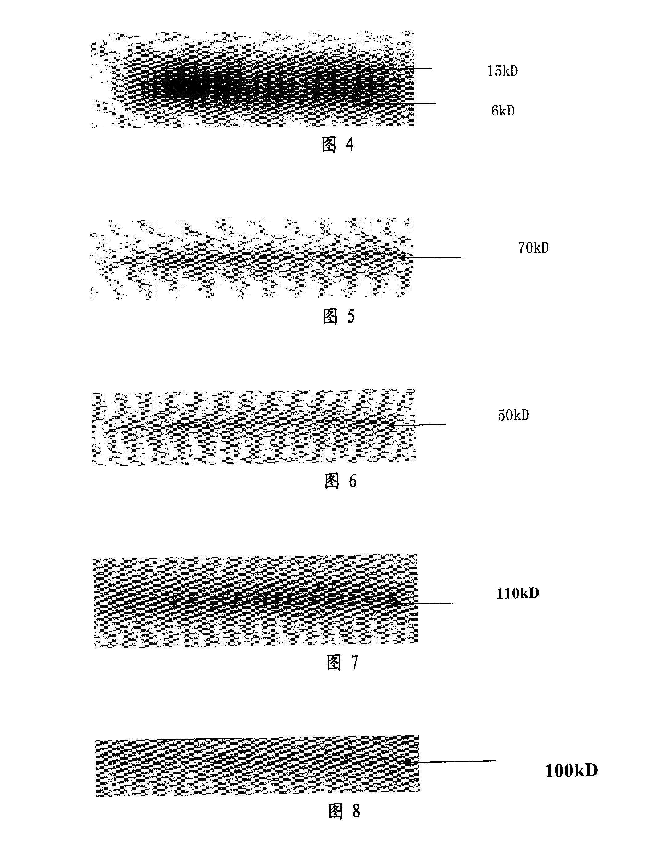 Medicine for treating senile dementia and preparing method thereof