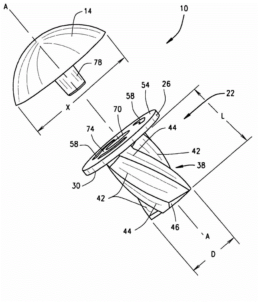 Joint implant and prosthesis and method