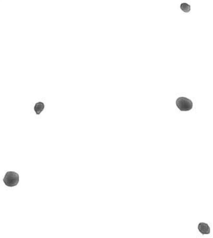 Cancer auxiliary analysis system and device based on HE staining pathological image