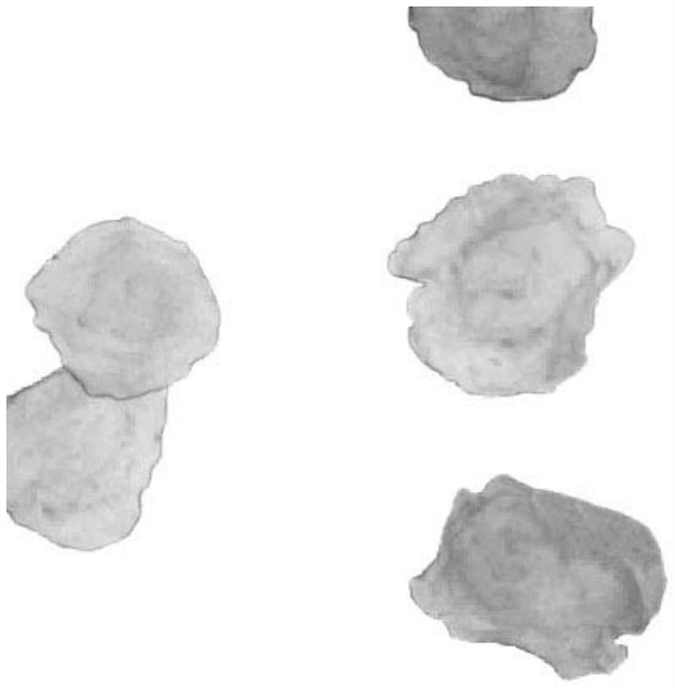 Cancer auxiliary analysis system and device based on HE staining pathological image