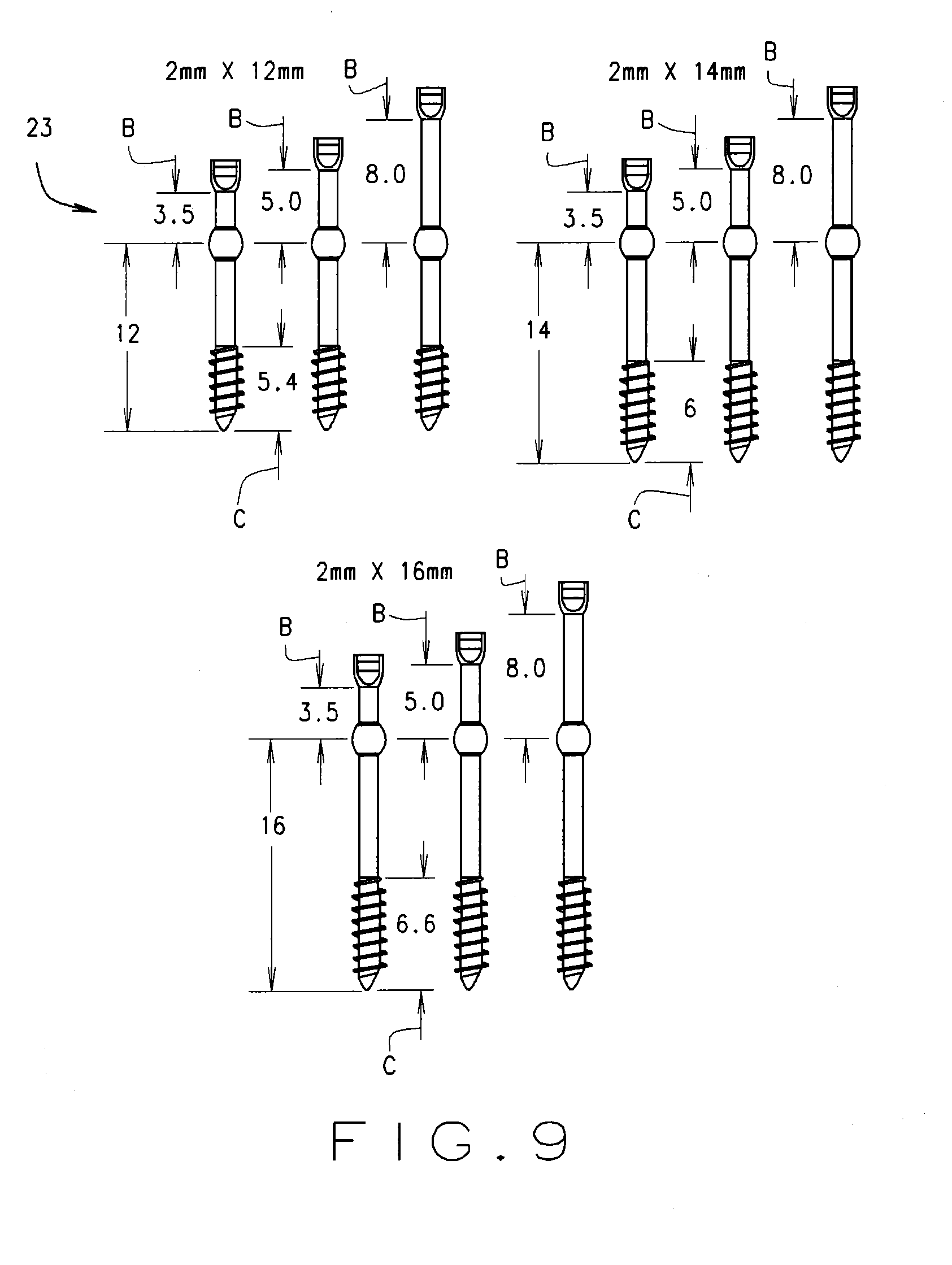 Minimal incision removable bone screw, driver, and method of use