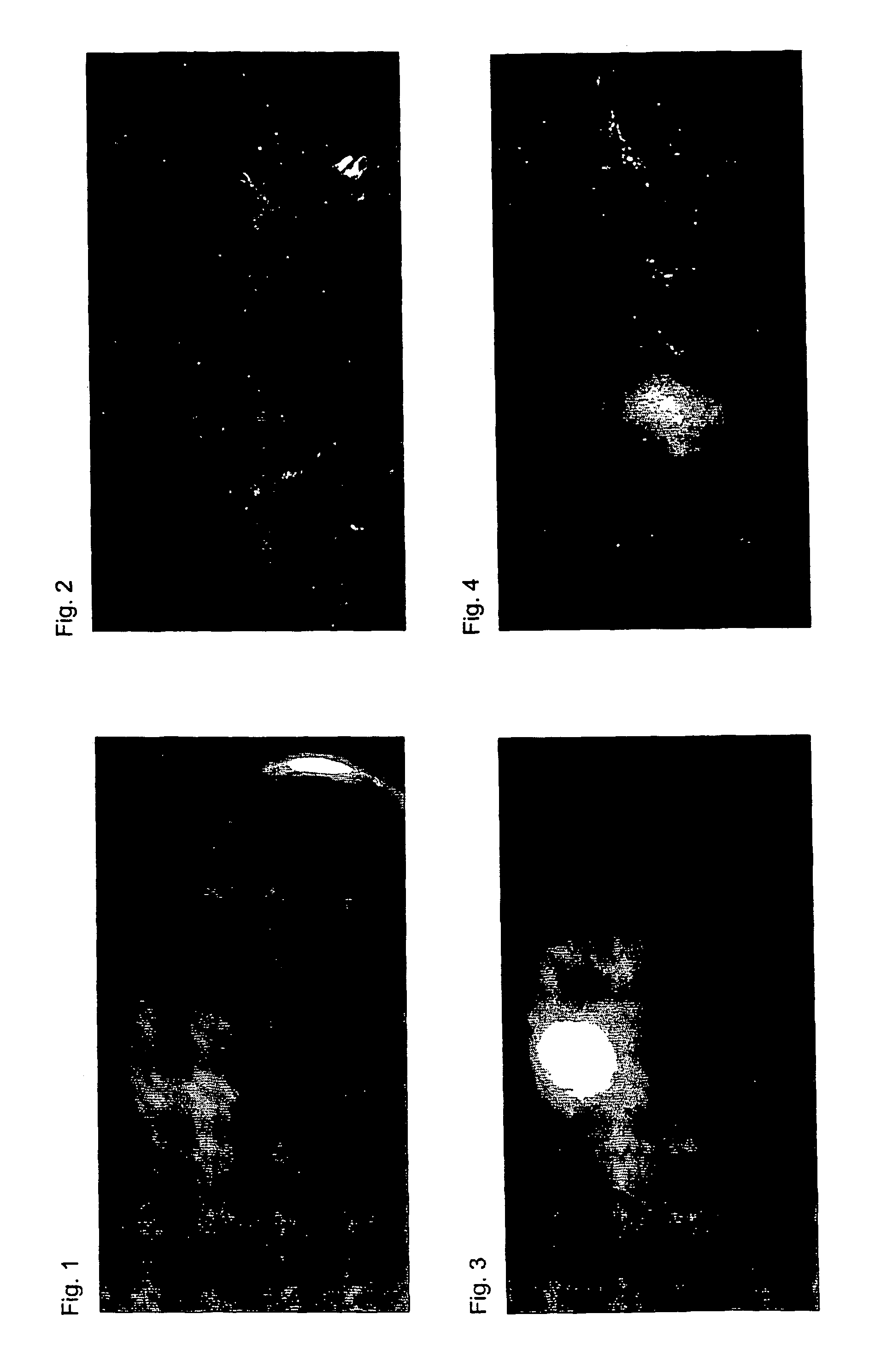 Near infrared fluorescent contrast agent and fluorescence imaging