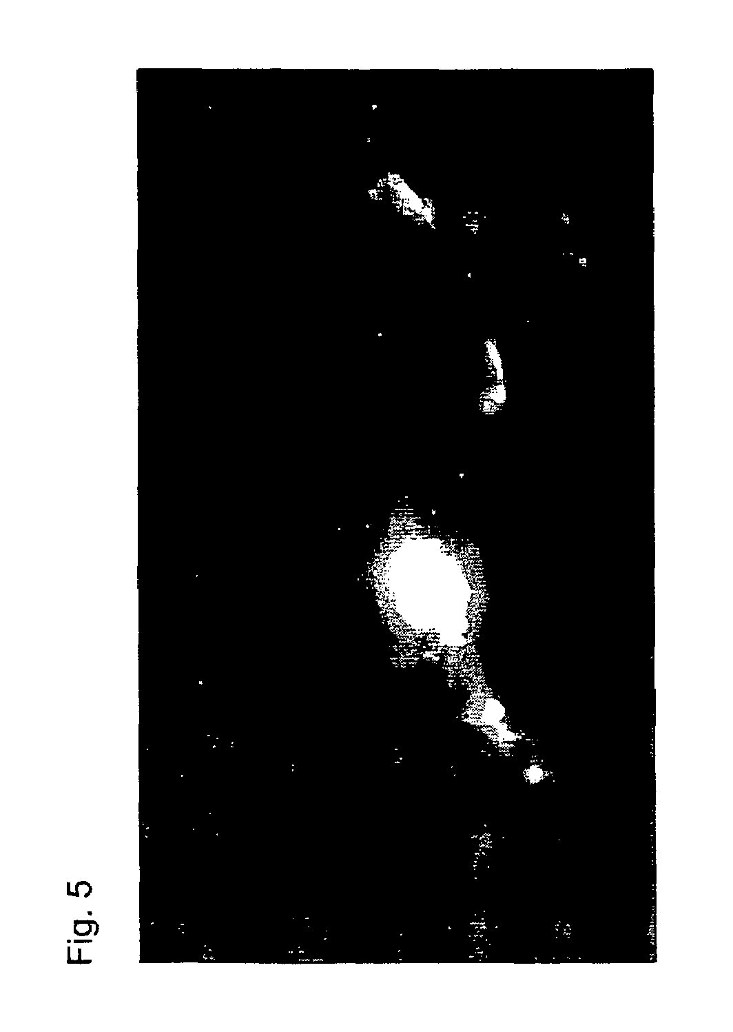 Near infrared fluorescent contrast agent and fluorescence imaging