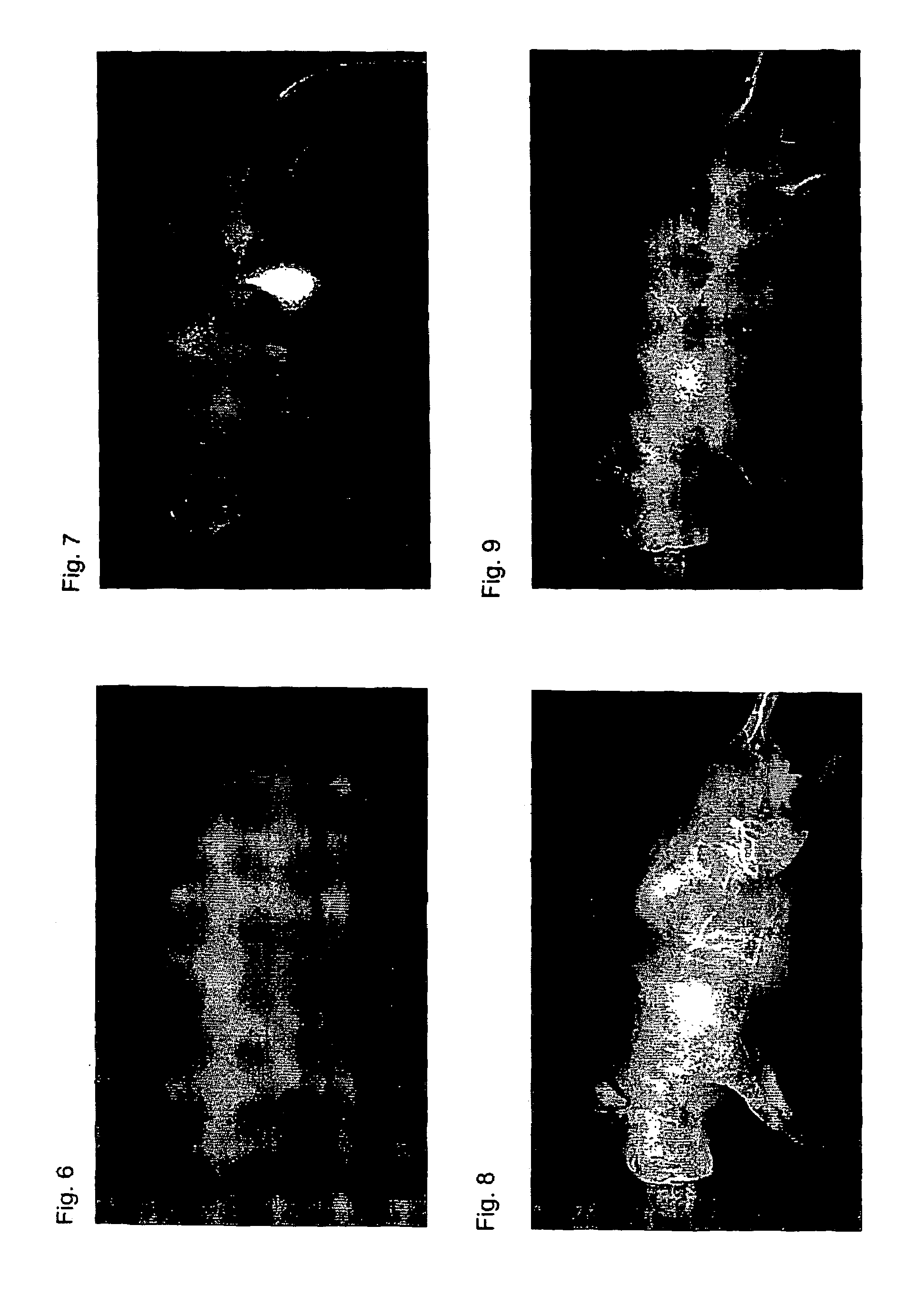 Near infrared fluorescent contrast agent and fluorescence imaging