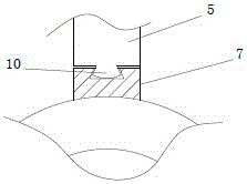 Rotary drainage tube fixation apparatus