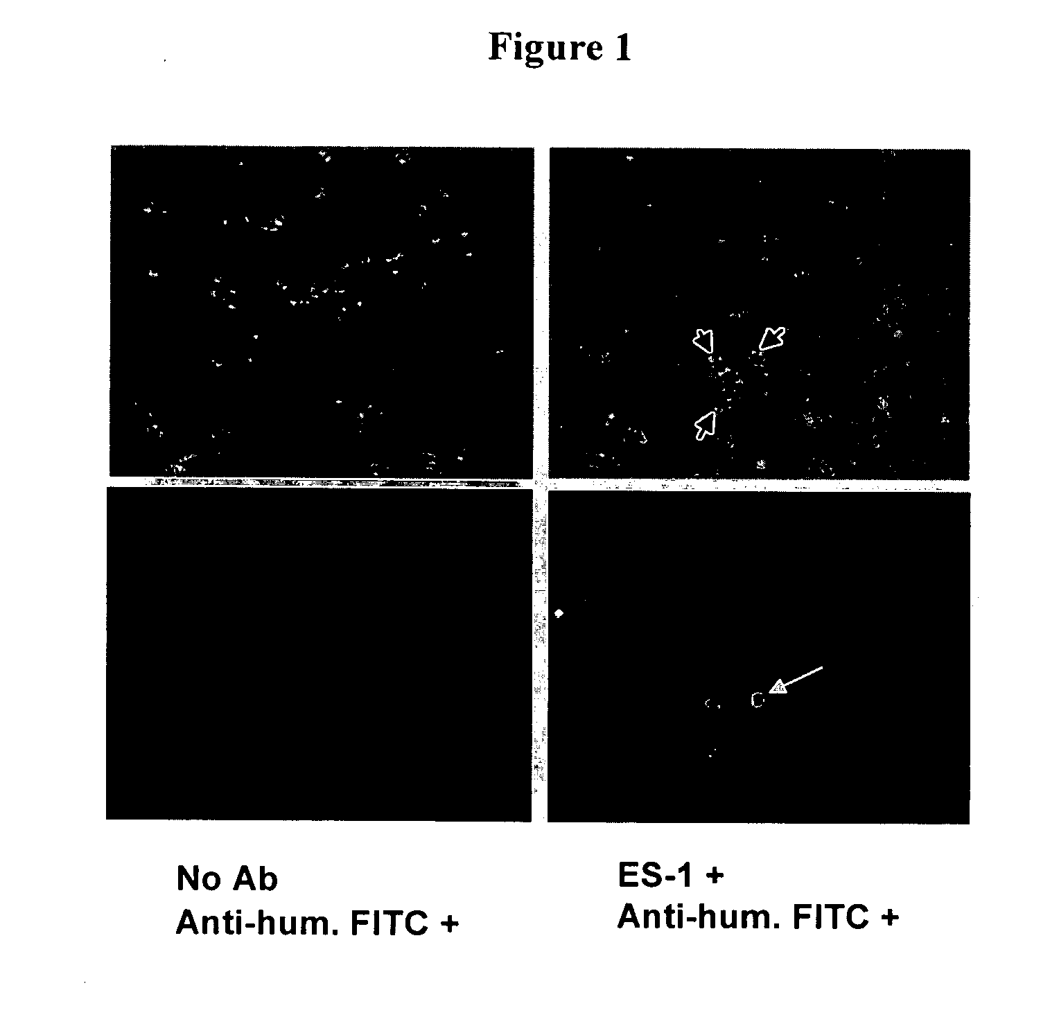 Antibodies with immune effector activity and that internalize in endosialin-positive cells