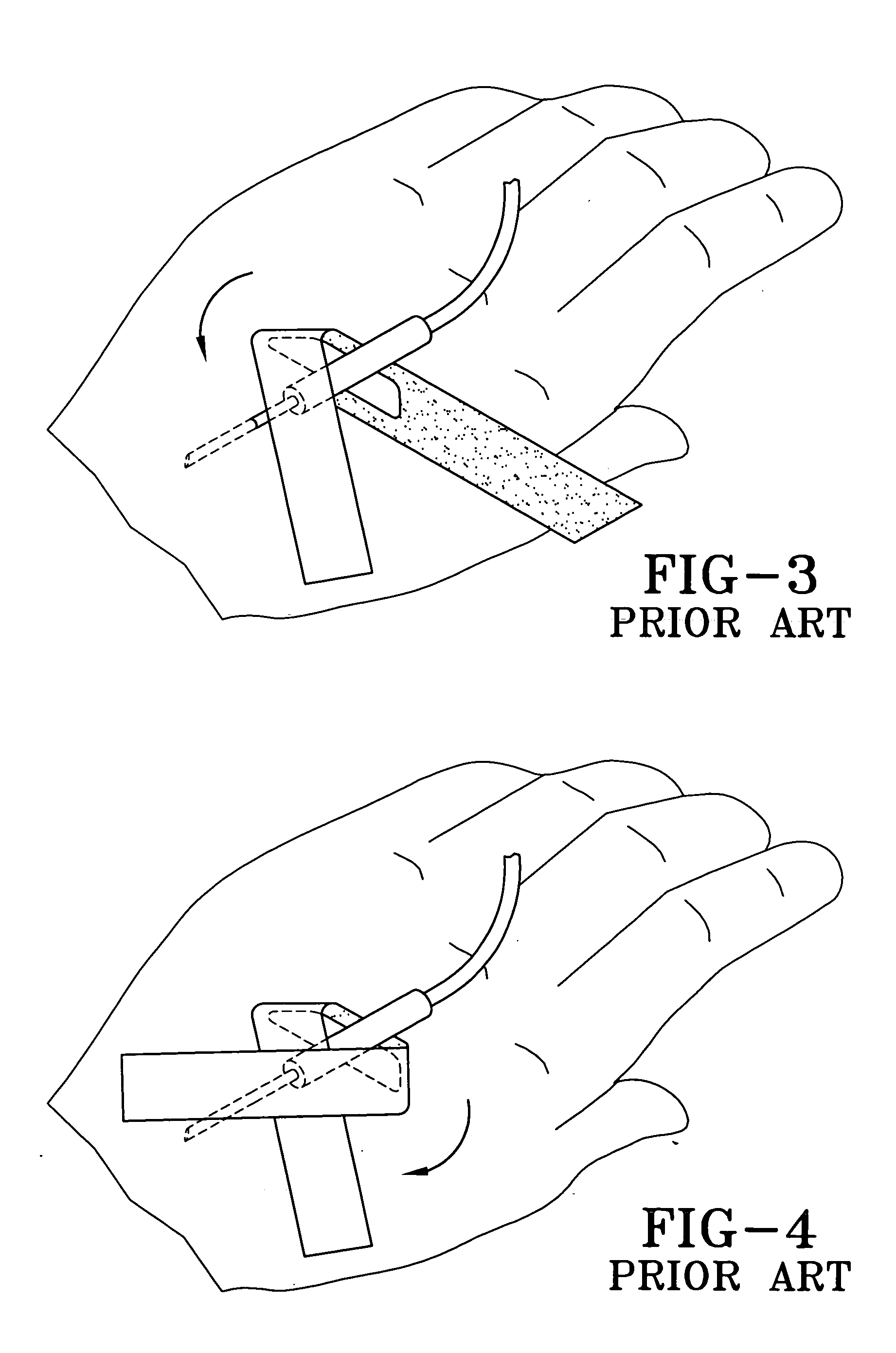 Adhesive tape for an intravascular catheter