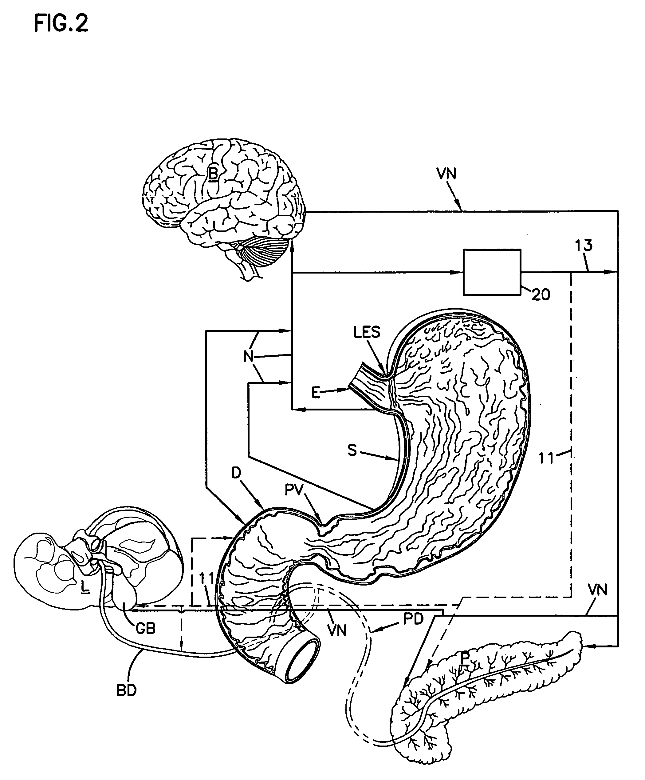 Bulimia treatment