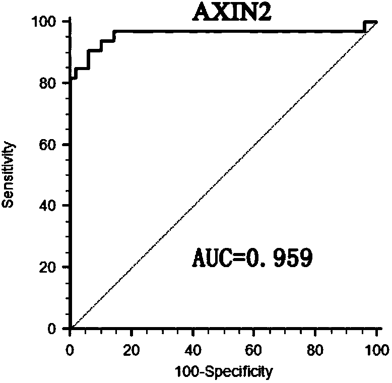 Kit for early diagnosis of papillary thyroid carcinoma